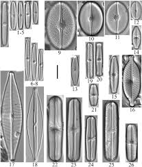 Attēlu rezultāti vaicājumam “Diachea sp.”