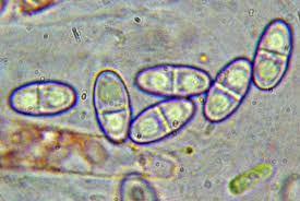 Attēlu rezultāti vaicājumam “Nectria peziza”
