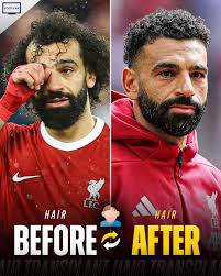 Image result for Liverpool Transplant FC