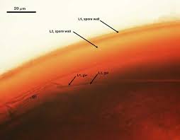 Attēlu rezultāti vaicājumam “Licea castanea spores”
