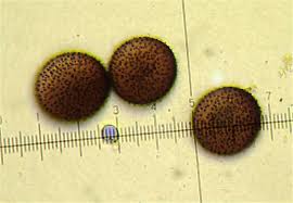 Attēlu rezultāti vaicājumam “Lamproderma debile spores”