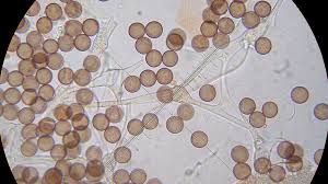 Attēlu rezultāti vaicājumam “Physarum leucopus spores”