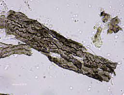 Attēlu rezultāti vaicājumam “Cystocoleus ebeneus”