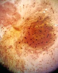 Attēlu rezultāti vaicājumam “Cribraria martinii”