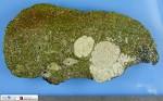 <b>hepatocellular carcinoma</b>