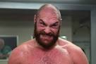 TYSON FURY vs Christian Hammer Weigh Ins - TSM PLUG