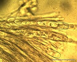 Attēlu rezultāti vaicājumam “Disciotis venosa”