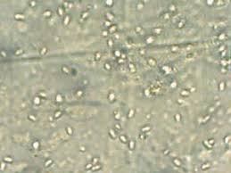 Attēlu rezultāti vaicājumam “Postia stiptica”