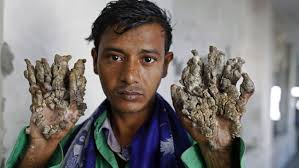 Image result for Lewandowsky-Lutz