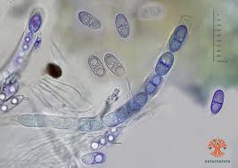 Attēlu rezultāti vaicājumam “Acrocordia gemmata”