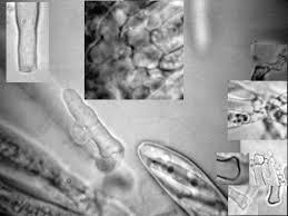 Attēlu rezultāti vaicājumam “Heyderia pusilla”