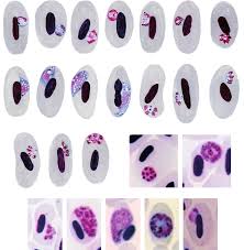 Attēlu rezultāti vaicājumam “Siphoptychium violaceum plasmodium”