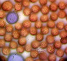 Attēlu rezultāti vaicājumam “Lycogala cf. oleocrystalliferum”