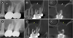 Image result for 뺾