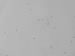 Attēlu rezultāti vaicājumam “Cribraria atrofusca spores”