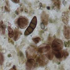 Attēlu rezultāti vaicājumam “Clastoderma debaryanum spores”