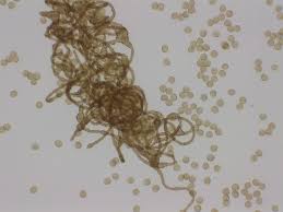 Attēlu rezultāti vaicājumam “Hemitrichia karstenii plasmodium”