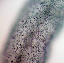 Attēlu rezultāti vaicājumam “Stemonitopsis aequalis var. microspora spores”