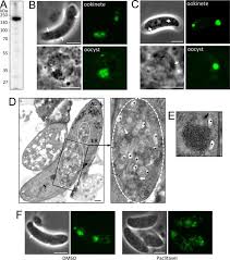 Attēlu rezultāti vaicājumam “Lignydium muscorum plasmodium”