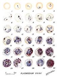Attēlu rezultāti vaicājumam “Enteridium variabile plasmodium”