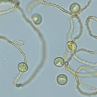 Attēlu rezultāti vaicājumam “Perichaena corticalis spores”