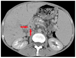 Image result for Redoubtables Cc