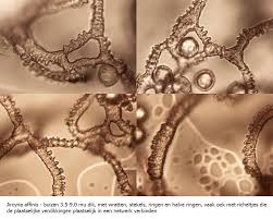 Attēlu rezultāti vaicājumam “Arcyria affinis”