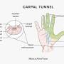 sa=U Carpal tunnel syndrome from www.medicalnewstoday.com