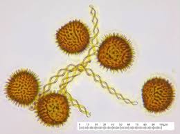 Attēlu rezultāti vaicājumam “Fossombronia wondraczekii”