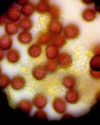 Attēlu rezultāti vaicājumam “Physarum, Nannengaella sp.”