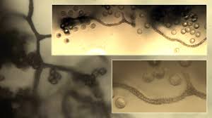 Attēlu rezultāti vaicājumam “Arcyria globosa”