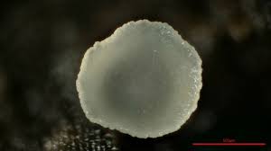 Attēlu rezultāti vaicājumam “Hyalorbilia inflatula”