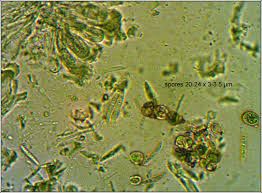 Attēlu rezultāti vaicājumam “Scoliciosporum chlorococcum”