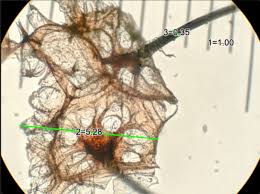 Attēlu rezultāti vaicājumam “Stemonitis fusca spores”