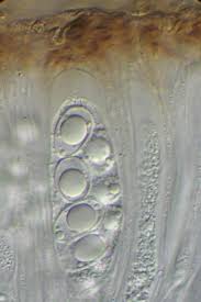 Attēlu rezultāti vaicājumam “Lecanora argentata”