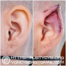 Image result for ear mod