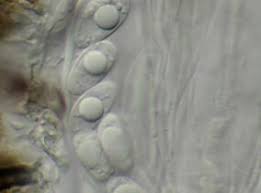 Attēlu rezultāti vaicājumam “Xylographa paralella”