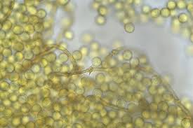 Attēlu rezultāti vaicājumam “Trichia flavicoma spores”