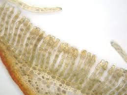 Attēlu rezultāti vaicājumam “Polytrichum juniperinum sporophyte”