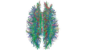 Image result for map of the brain