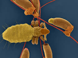 Attēlu rezultāti vaicājumam “Liceaceae”