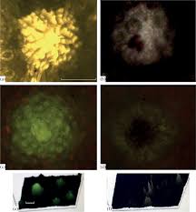 Attēlu rezultāti vaicājumam “Calypogeia azurea macro”