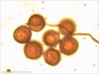 Attēlu rezultāti vaicājumam “Diderma spumarioides”