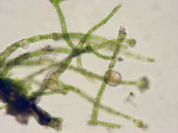 Attēlu rezultāti vaicājumam “Trentepohlia sp.”