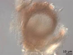 Attēlu rezultāti vaicājumam “Mycosphaerella millegrana”