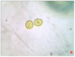 Attēlu rezultāti vaicājumam “Hemitrichia serpula spores”