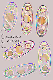 Attēlu rezultāti vaicājumam “Octosporella jungermanniarum”