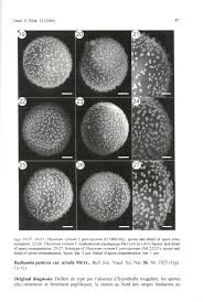 Attēlu rezultāti vaicājumam “Physarum virescens spores”