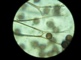 Attēlu rezultāti vaicājumam “Physarum braunianum spores”