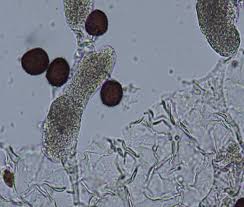 Attēlu rezultāti vaicājumam “Physarum compressum stalked”